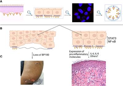 Insights Into the Pathogenesis of Bullous Pemphigoid: The Role of Complement-Independent Mechanisms